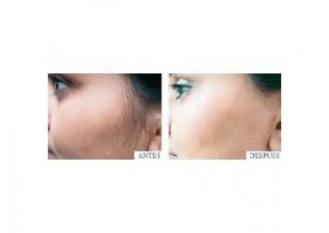 PRECIOS!!!-Cejas superior/inferior y entrecejo....