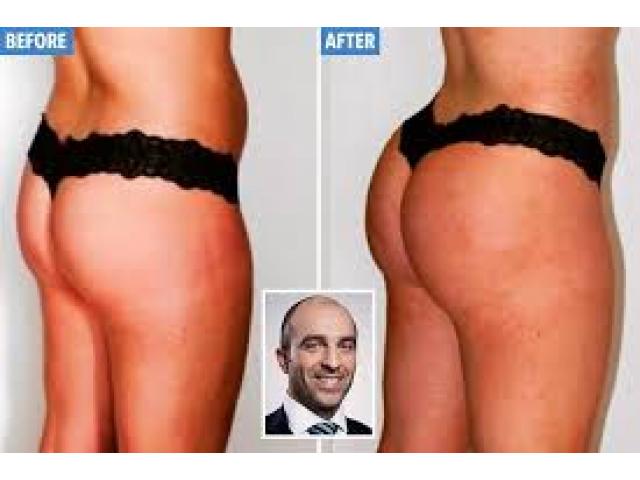 HIPS AND BUMS ENLARGEMENT CREAM AND PILLS +276057759 63 IN MALAYSIA ,SINGAPORE ,USA ,AUSTRALIA63