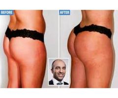 HIPS AND BUMS ENLARGEMENT CREAM AND PILLS +276057759 63 IN MALAYSIA ,SINGAPORE ,USA ,AUSTRALIA63