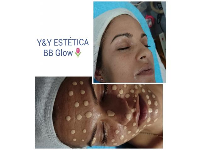 Y&Y Estética BB Glow, Dermapen, microneedle, fototerapia, mesoterapia