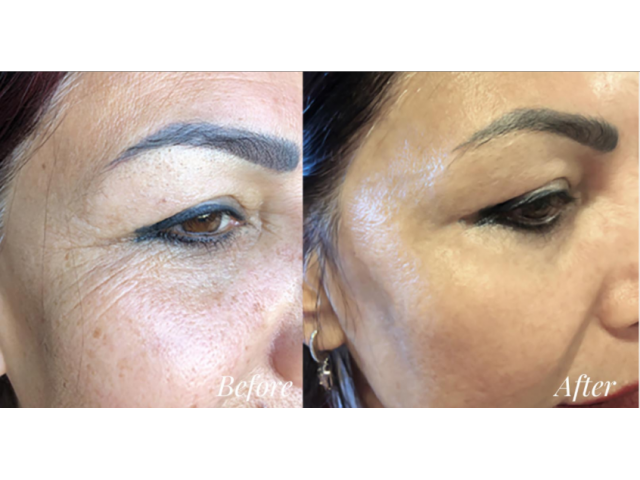 KISS BEAUTY SNAIL  SKIN  LIGHTENING  AND MOISTURIZING HERBAL CREAMS