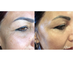 KISS BEAUTY SNAIL  SKIN  LIGHTENING  AND MOISTURIZING HERBAL CREAMS